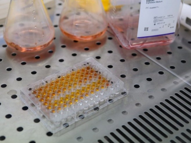 Тестирање (фото: EPA/JAKUB KACZMARCZYK POLAND OUT - илустрација) - 