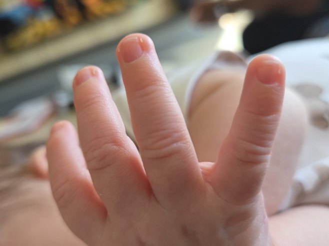 Беба - Фото: РТРС